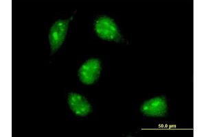 Immunofluorescence of monoclonal antibody to MAX on HeLa cell. (MAX anticorps  (AA 1-151))