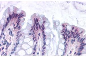 Anti-GPR82 antibody  ABIN1048877 IHC staining of human colon. (GPR82 anticorps  (Cytoplasmic Domain))