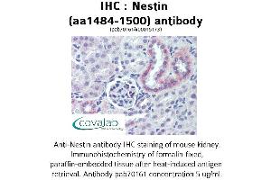Image no. 1 for anti-Nestin (NES) (AA 1484-1500) antibody (ABIN1737269) (Nestin anticorps  (AA 1484-1500))
