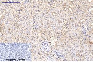 Immunohistochemical analysis of paraffin-embedded rat kidney tissue. (Collagen Type I anticorps)