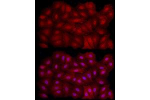 Immunofluorescence analysis of A-549 cells using [KO Validated] SIRT1 Rabbit pAb (ABIN7270322) at dilution of 1:200 (40x lens). (SIRT1 anticorps)
