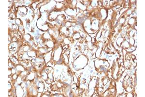 Formalin-fixed, paraffin-embedded human Placenta stained with Ezrin Mouse Monoclonal Antibody (CPTC-Ezrin-1). (Ezrin anticorps)