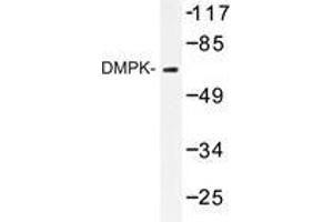 Western blot analysis of DMPK antibody in extracts from Jurkat cell. (DMPK anticorps)