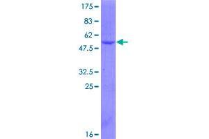 Image no. 1 for serine/arginine-Rich Splicing Factor 3 (SRSF3) (AA 1-164) protein (GST tag) (ABIN1319754)