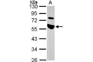 WB Image Sample (30 ug of whole cell lysate) A: A549 10% SDS PAGE antibody diluted at 1:1000 (TRAIP anticorps)