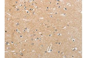 The image on the left is immunohistochemistry of paraffin-embedded Human brain tissue using ABIN7191635(NFASC Antibody) at dilution 1/30, on the right is treated with synthetic peptide. (NFASC anticorps)