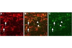 Expression of proNGF in rat brain sectionsImmunohistochemical staining of proNGF in rat brain sections using Anti-proNGF Antibody (ABIN7043556, ABIN7044751 and ABIN7044752). (Nerve Growth Factor (NGF) Peptide)