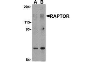 Western Blotting (WB) image for anti-RAPTOR (RAPTOR) (N-Term) antibody (ABIN1031532) (RAPTOR anticorps  (N-Term))