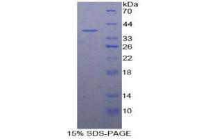 SDS-PAGE analysis of Human Metallothionein 3 Protein. (MT3 Protéine)