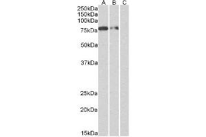 (1 µg/ml, right panel) staining of Multitag protein at 25 ng (A), 10 ng (B) and 5 ng (C) amounts. (Recombinant His Tag anticorps)