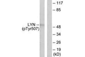 Western blot analysis of extracts from K562 cells treated with H2O2 100uM 30', using Lyn (Phospho-Tyr507) Antibody.