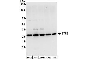 Western Blotting (WB) image for anti-Electron-Transfer-Flavoprotein, beta Polypeptide (ETFB) (AA 205-255) antibody (ABIN7449727)