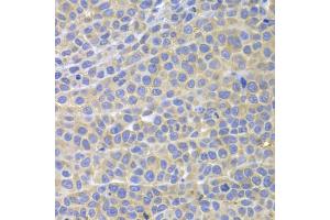 Immunohistochemistry of paraffin-embedded mouse cancer using STAT4 antibody. (STAT4 anticorps)