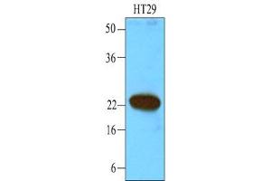 Western Blotting (WB) image for anti-Calcium and Integrin-Binding Protein 1 (CIB1) (AA 1-191), (N-Term) antibody (ABIN238365)
