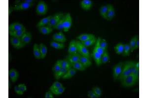 Immunofluorescence staining of HepG2 cells with ABIN7175437 at 1:100, counter-stained with DAPI.