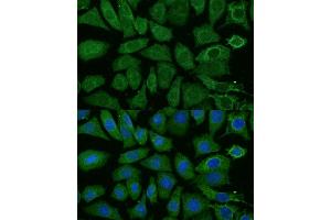 Immunofluorescence analysis of L929 cells using NDUFB4 Polyclonal Antibody (ABIN6133349, ABIN6144476, ABIN6144477 and ABIN7101430) at dilution of 1:100 (40x lens).