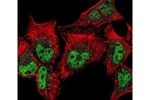 Fluorescent confocal image of HeLa cell stained with MEF2C antibody.