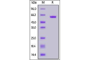 SARS-CoV-2 S protein RBD (K417T, E484K, N501Y), Fc Tag on  under reducing (R) condition. (SARS-CoV-2 Spike Protein (P.1 - gamma, RBD) (Fc Tag))