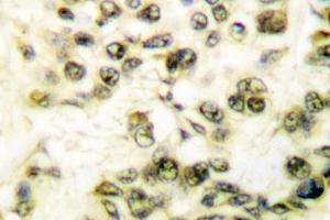 Image no. 1 for anti-Protein Kinase, DNA-Activated, Catalytic Polypeptide (PRKDC) antibody (ABIN265386)