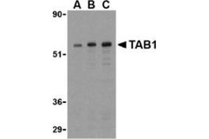 Western blot analysis of TAB1 in 3T3 cell lysate with this product at (A) 0. (TAB1 anticorps  (Center))
