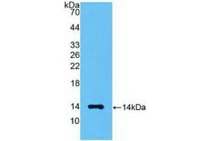 WB of Protein Standard: different control antibodies against Highly purified E.