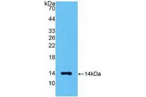 WB of Protein Standard: different control antibodies against Highly purified E. (MSTN Kit ELISA)