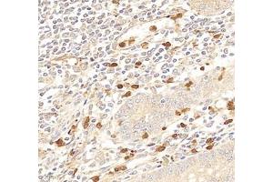 Immunohistochemistry of paraffin embedded human epityphlon using IL-27A (ABIN7074367) at dilution of 1: 400 (400x lens)