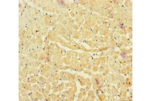 Immunohistochemistry of paraffin-embedded human heart tissue using ABIN7161254 at dilution of 1:100