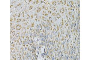 Immunohistochemistry of paraffin-embedded Human esophagus using AP2B1 Polyclonal Antibody at dilution of 1:100 (40x lens). (AP2B1 anticorps)
