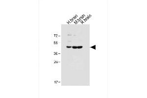 All lanes : Anti-DUSP6 Antibody (Center) at 1:500 dilution Lane 1: Human brain tissue lysate Lane 2: Mouse brain tissue lysate Lane 3: Rat brain tissue lysate Lysates/proteins at 20 μg per lane.