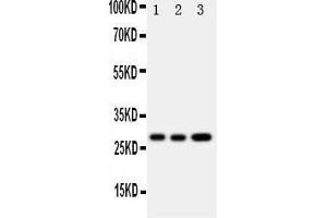 Western Blotting (WB) image for anti-Oncostatin M (OSM) (AA 181-198), (Middle Region) antibody (ABIN3043117) (Oncostatin M anticorps  (Middle Region))