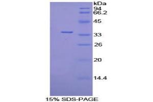 SDS-PAGE analysis of Mouse PDK4 Protein.
