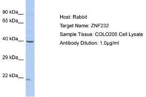 Host: Rabbit Target Name: ZNF232 Sample Type: COLO205 Whole cell lysates Antibody Dilution: 1. (ZNF232 anticorps  (N-Term))