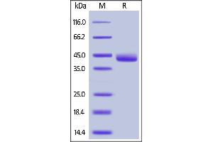Mouse Galectin-4, His Tag on  under reducing (R) condition. (GAL4 Protein (AA 1-326) (His tag))