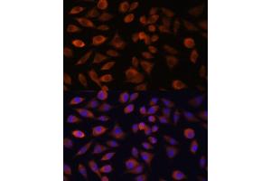 Immunofluorescence analysis of L929 cells using TRIM47 antibody (ABIN7270991) at dilution of 1:100.