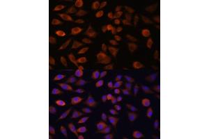 Immunofluorescence analysis of L929 cells using TRIM47 antibody (ABIN7270991) at dilution of 1:100.