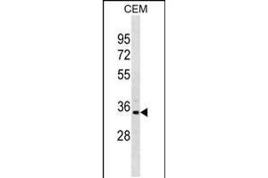 Western blot analysis in CEM cell line lysates (35ug/lane). (PRPS1L1 anticorps  (N-Term))