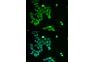 Immunofluorescence analysis of U2OS cells using PJA2 antibody (ABIN5973844). (PJA2 anticorps)