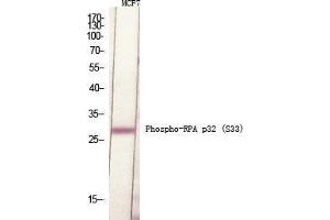 Western Blot (WB) analysis of specific cells using Phospho-RPA p32 (S33) Polyclonal Antibody. (RPA2 anticorps  (pSer33))
