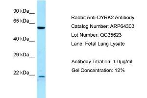 Western Blotting (WB) image for anti-Dual-Specificity tyrosine-(Y)-phosphorylation Regulated Kinase 2 (DYRK2) (C-Term) antibody (ABIN2789799) (DYRK2 anticorps  (C-Term))