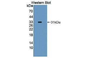 Western Blotting (WB) image for anti-Forkhead Box O1 (FOXO1) (AA 333-557) antibody (ABIN3207927) (FOXO1 anticorps  (AA 333-557))
