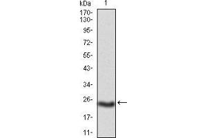 Western Blotting (WB) image for anti-Polycystic Kidney and Hepatic Disease 1 Protein (PKHD1) (AA 3878-4060) antibody (ABIN5874230) (PKHD1 anticorps  (AA 3878-4060))