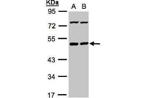 WB Image Sample(30 ug whole cell lysate) A:HeLa S3, B:Hep G2 , 10% SDS PAGE antibody diluted at 1:1000 (PSKH1 anticorps)