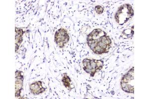 IHC analysis of TIMM17A using anti-TIMM17A antibody (ABIN6719637).