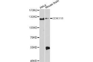 Western blot analysis of extracts of various cell lines, using CDK11B Antibody.