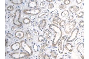 DAB staining on IHC-P; Samples: Human Esophagus (Galectin 2 anticorps  (AA 1-132))