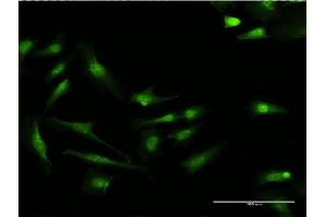 Immunofluorescence of monoclonal antibody to S100P on HeLa cell.