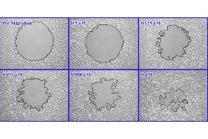 Cellular Assay (CA) image for Radius™ 24-Well Cell Migration Assay (ABIN2344873)