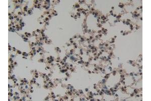 DAB staining on IHC-P; Samples: Mouse Lung Tissue