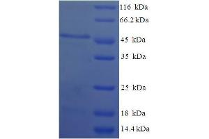SDS-PAGE (SDS) image for Hydroxysteroid (17-Beta) Dehydrogenase 11 (HSD17B11) (AA 20-300) protein (His-SUMO Tag) (ABIN5711619)